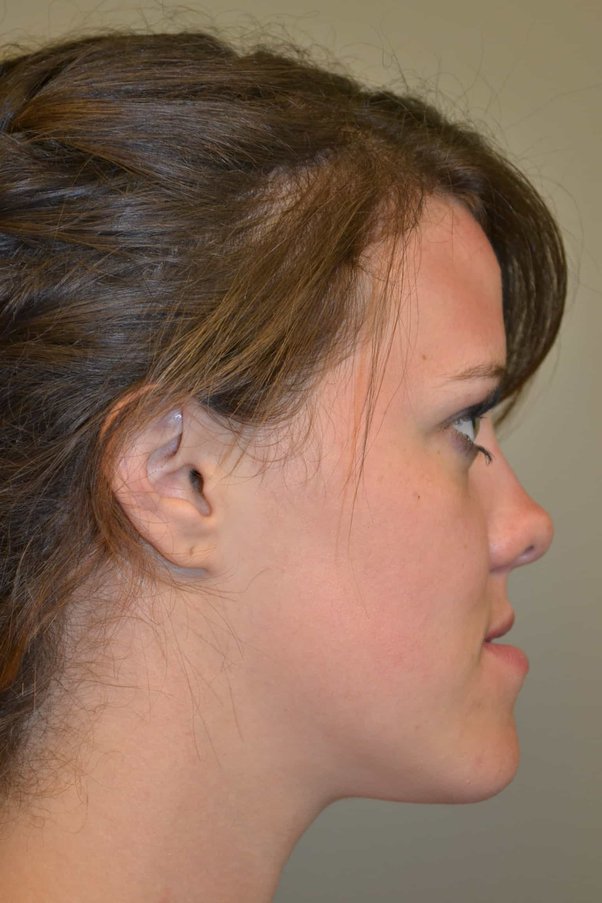 main-qimg-e53fb95137f9728b10752d2ef06a7650-lq