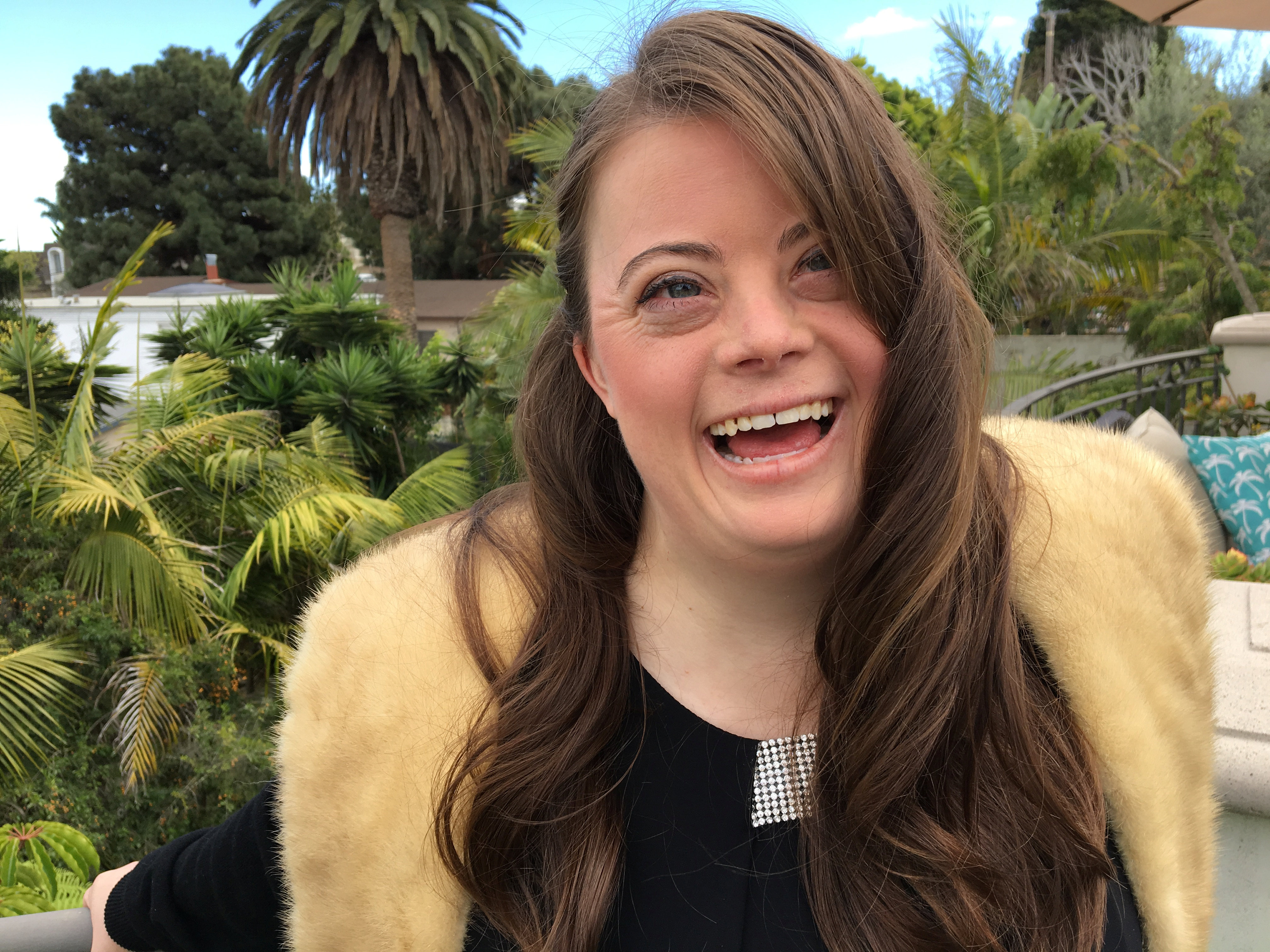 downs-syndrome-134883.jpg