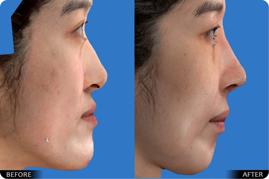 thumbs_Orthognathic_178-1024x683.jpg