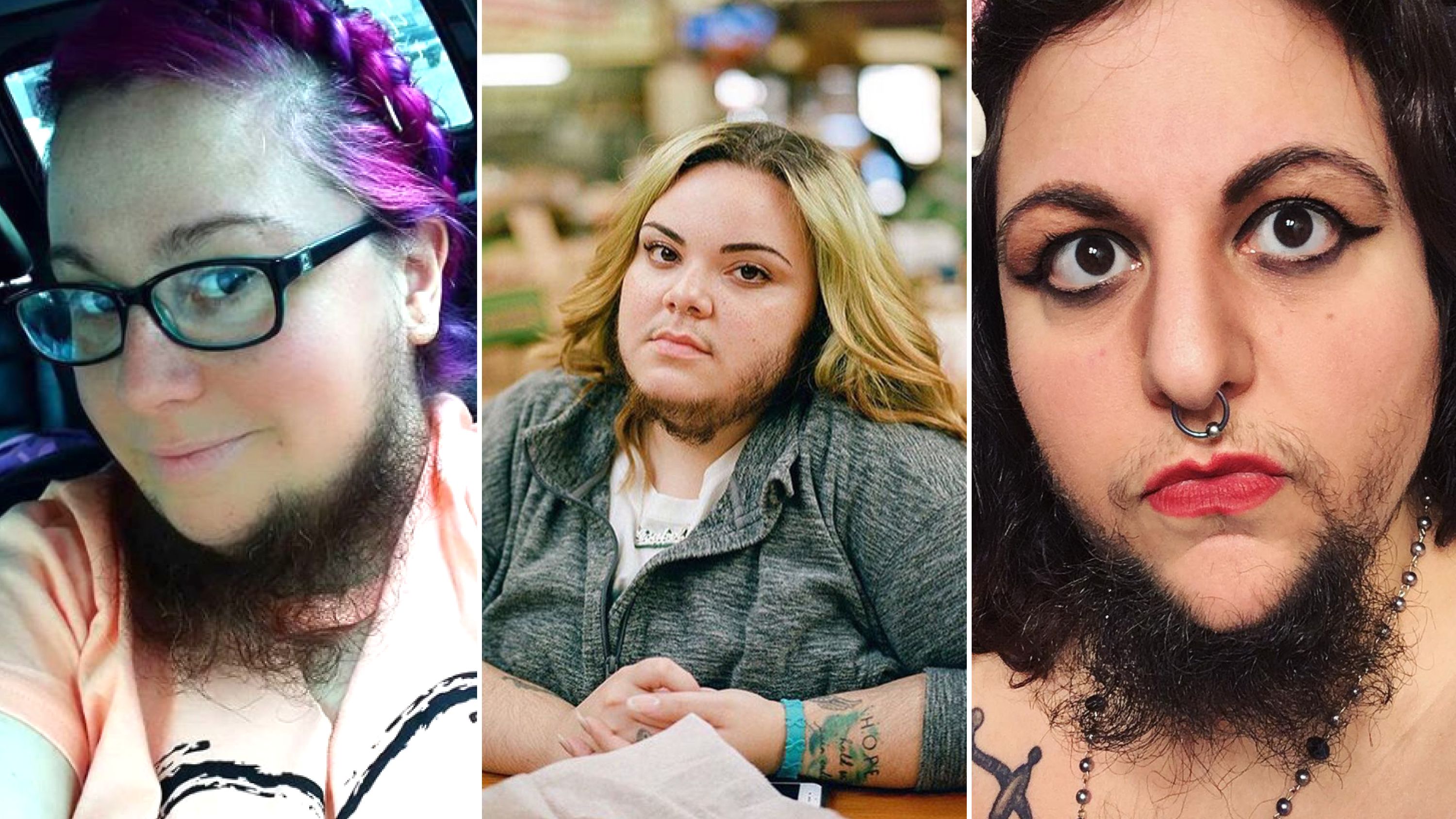 femalefacialhair.jpg