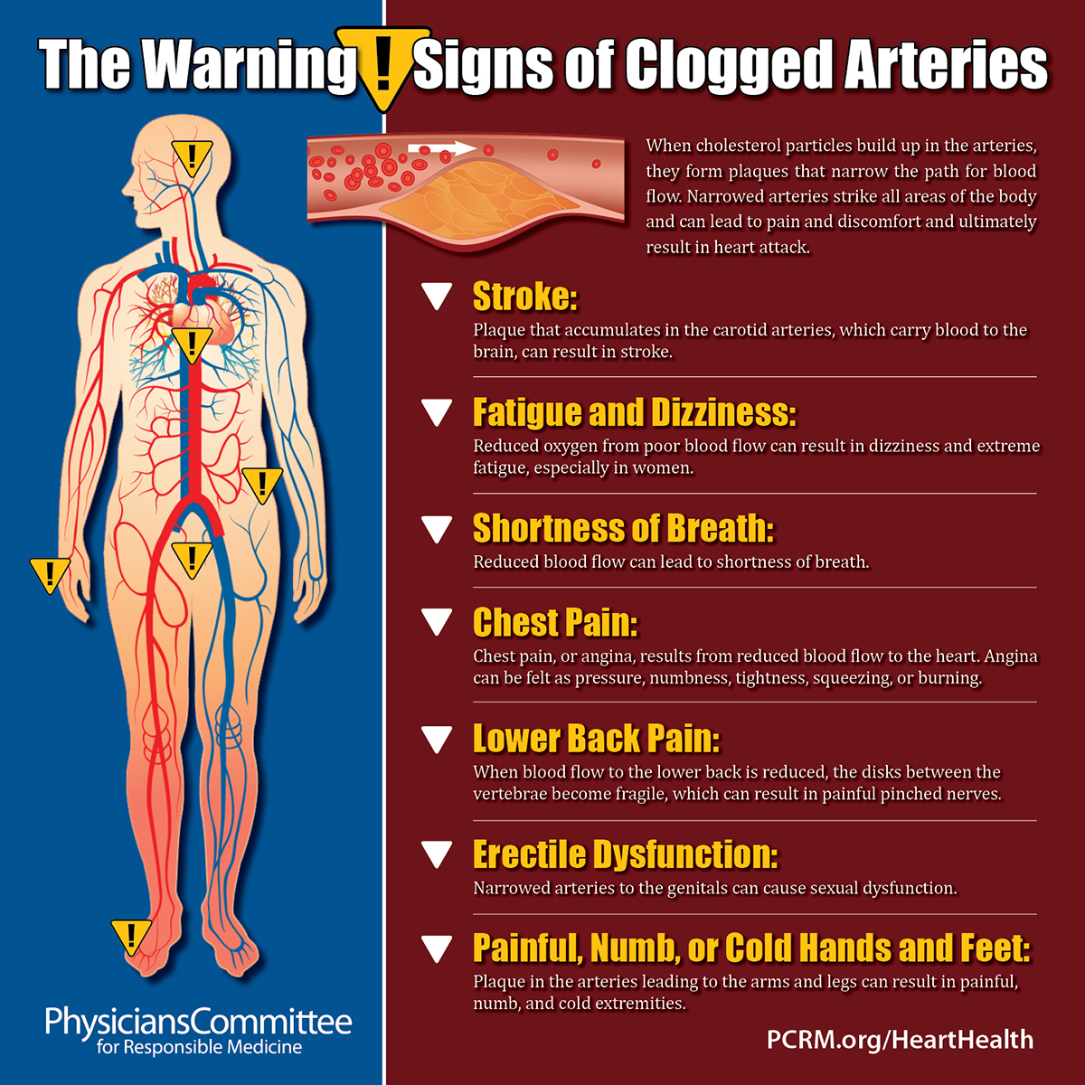 clogged-arteries-signs.jpg