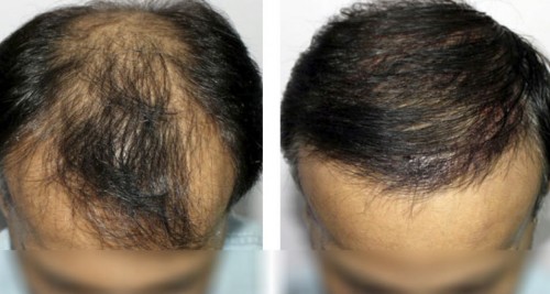 modenahair.com