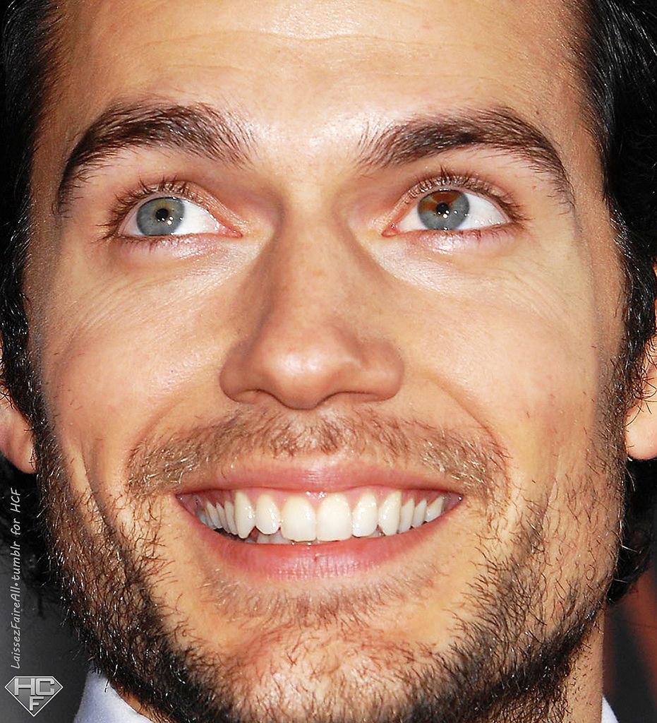 Actor Henry Cavill has sectoral heterochromia in his left eye. It is mostly  blue, with a couple of brown streaks. | Henry cavill, Henry caville, Henry  cavill eyes