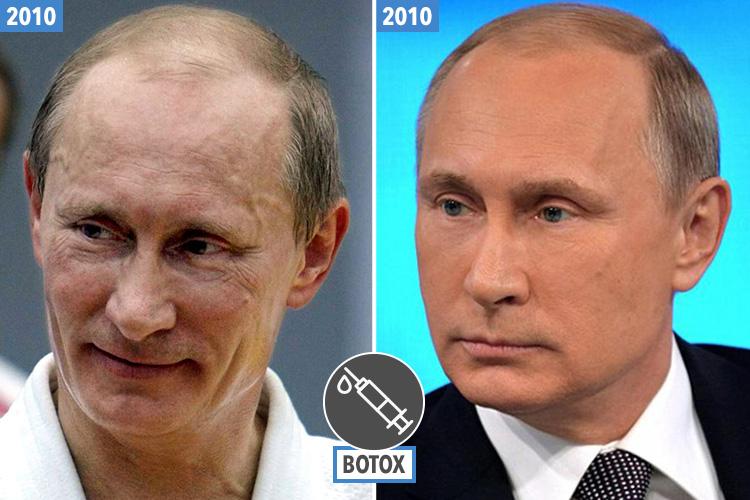es-putin-botox-composite-twin-up-inset.jpg