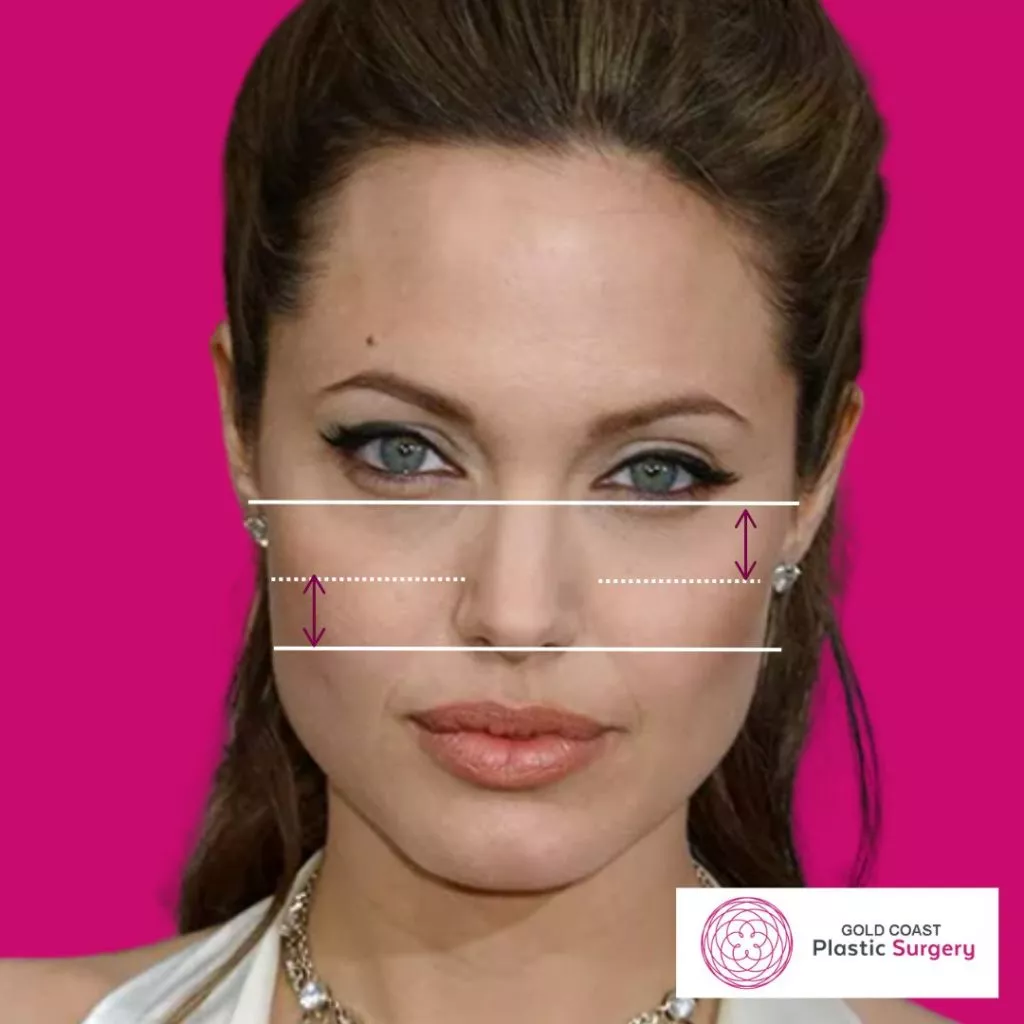 High vs Low Cheekbones: How do you know?