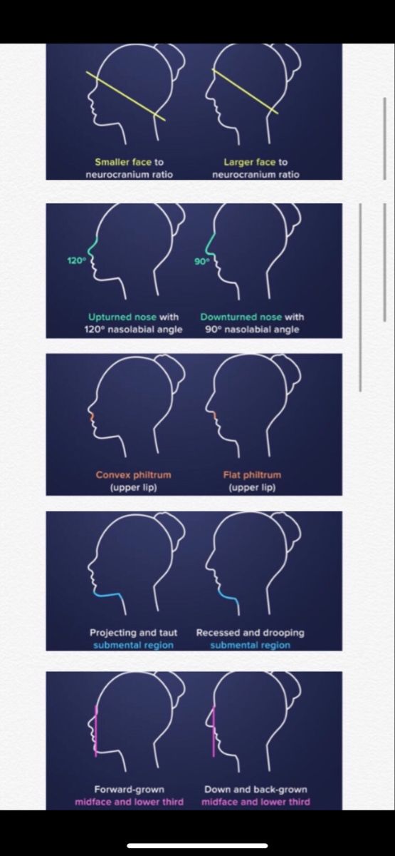angel skull vs witch skull | Face study, Wish board, Side profile