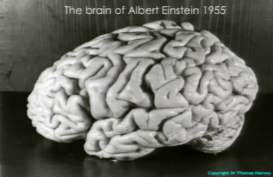 Einstein_brain_-_T.Harvey.png
