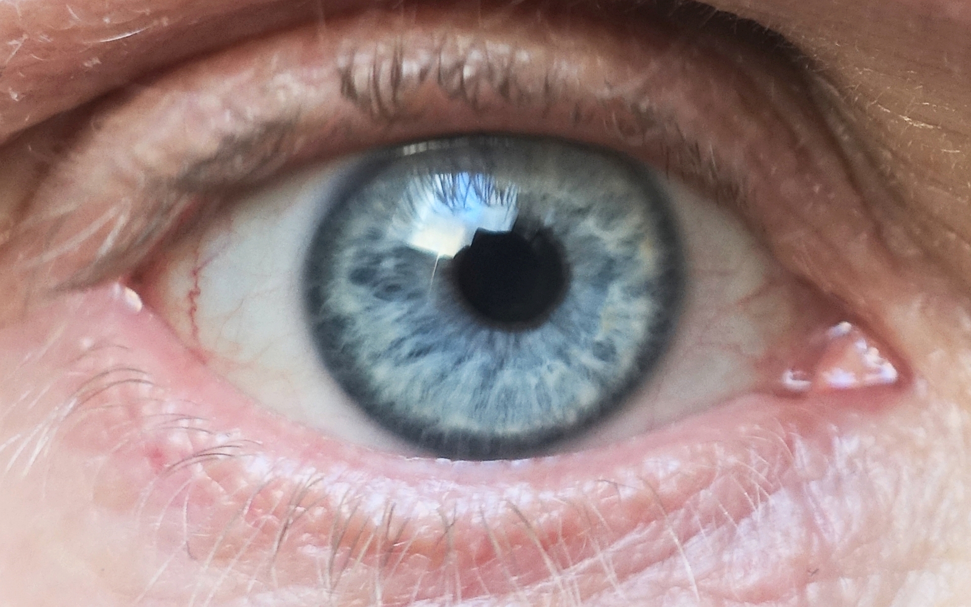 Blue_eye_2.jpg