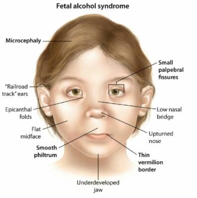 abnormal-facial-398x400.jpg