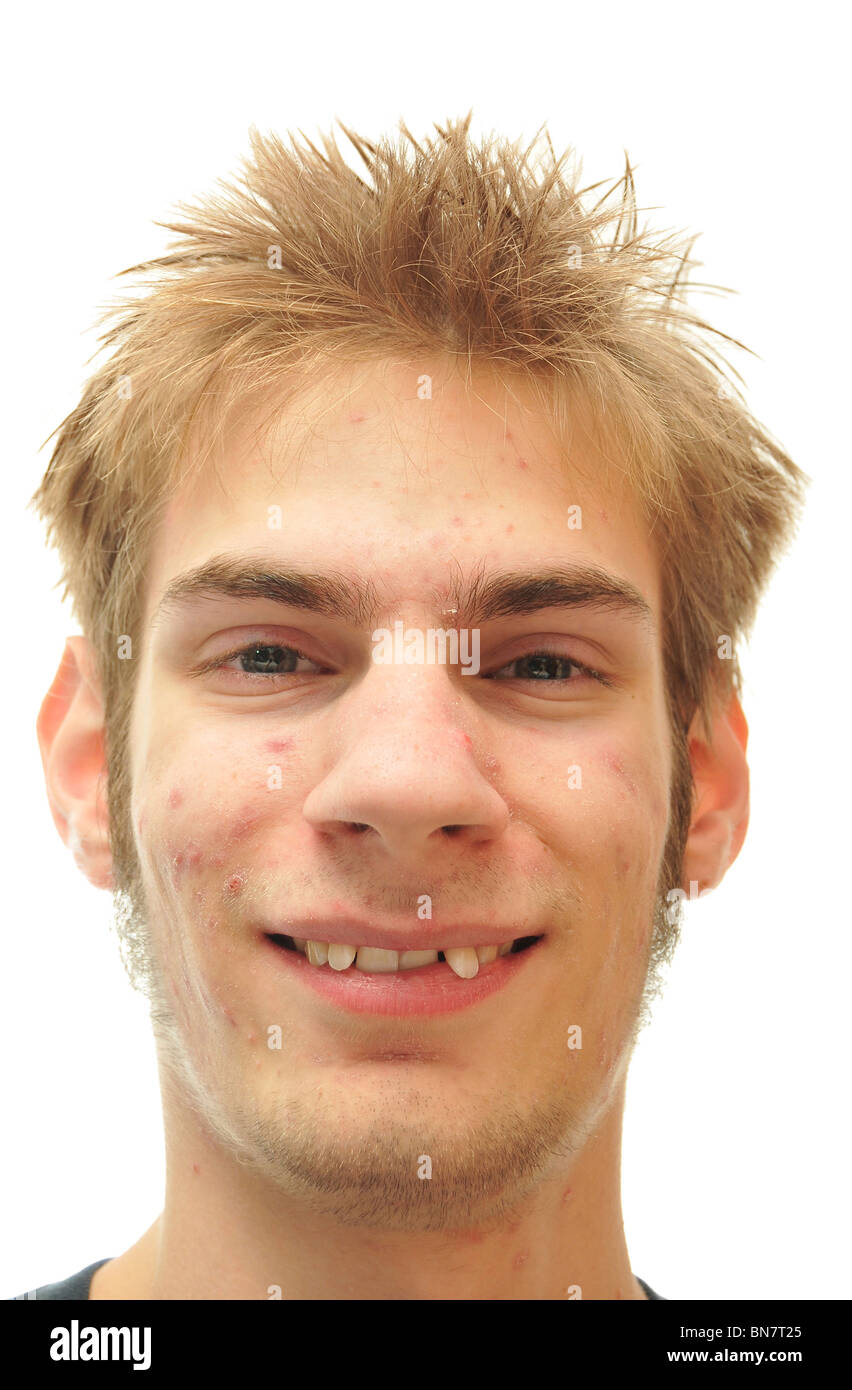 man-trying-to-smile-with-crooked-teeth-isolated-on-white-BN7T25.jpg