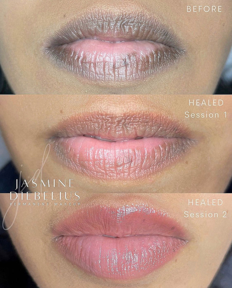 before_after_healed_lip_magic_1024x1024.jpg