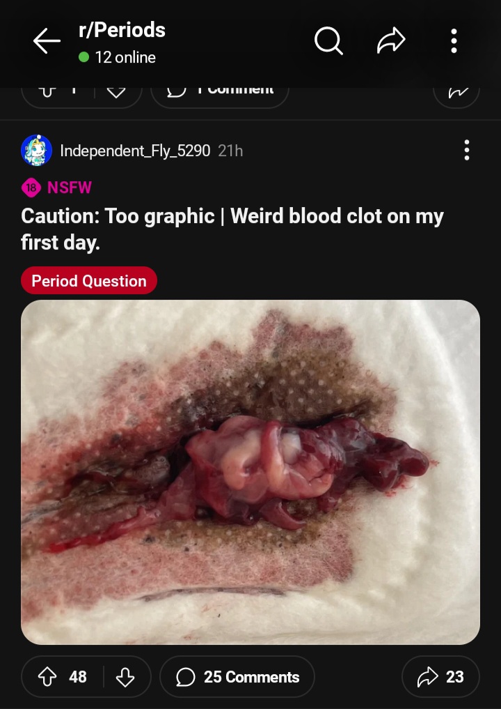 Screenshot 20240504 093423 Reddit