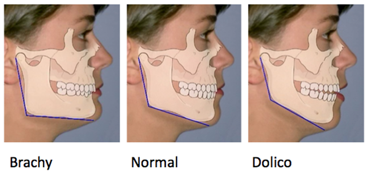 OrthoED-Evaluation-of-the-face-4.png
