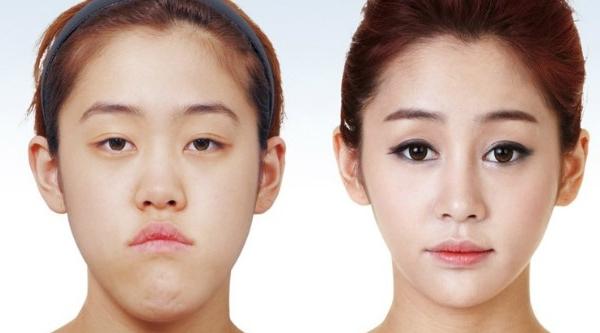 Plastic surgery & the quest for the perfect selfie in South Korea