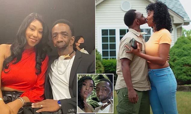 Woman who married a man born with no jaw  says people accuse her of FAKING her feelings