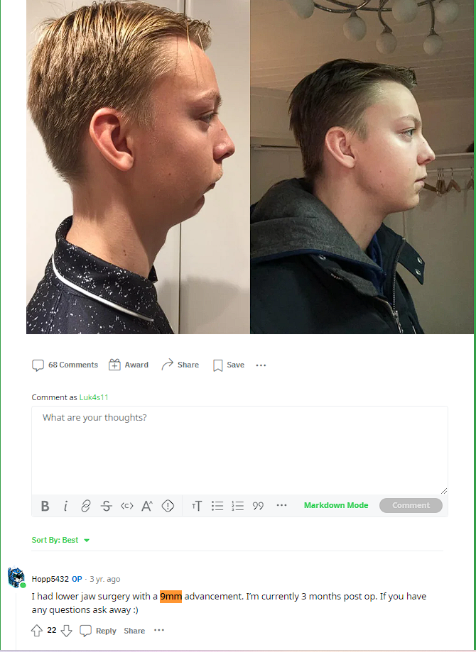 c71d4c30a552de266579ead28dbfc012.png