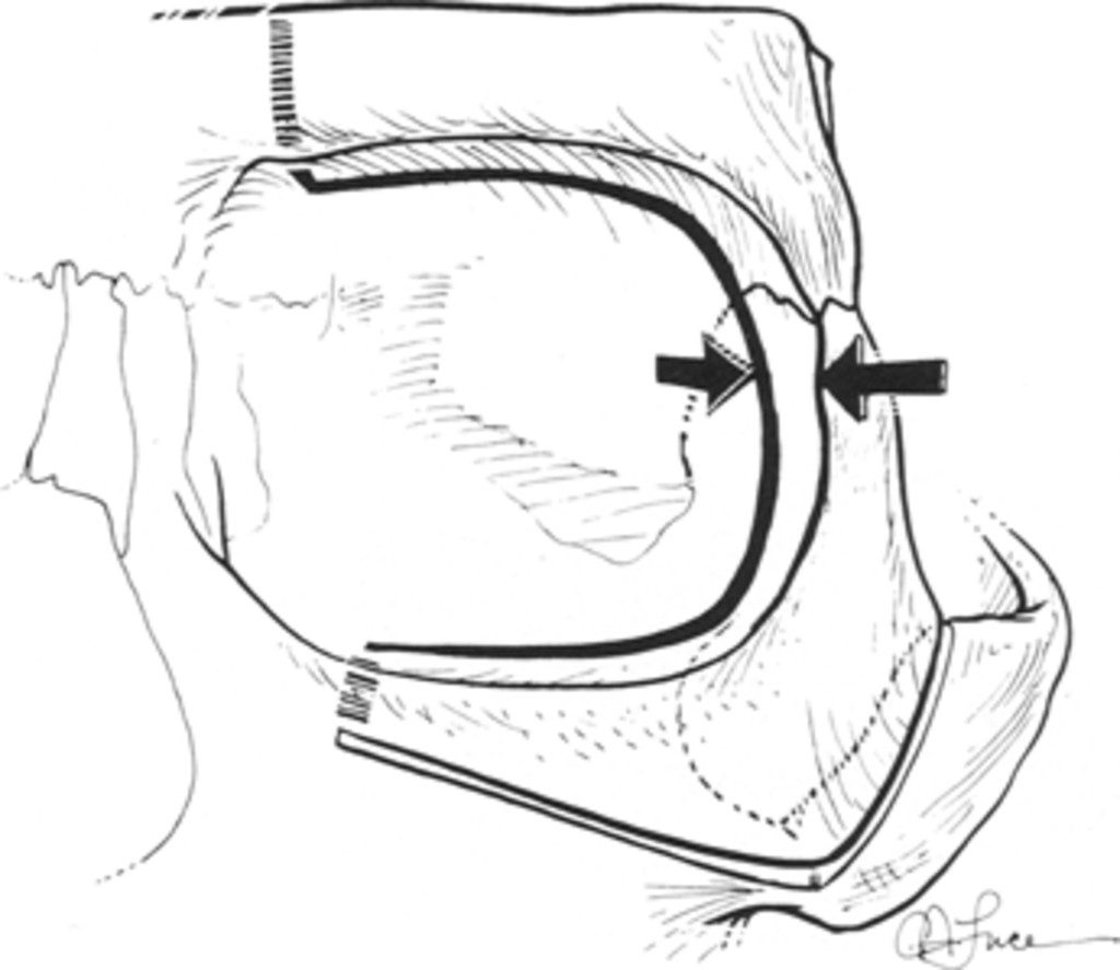 full-jns_1990_72_1_0022.fig003.jpg