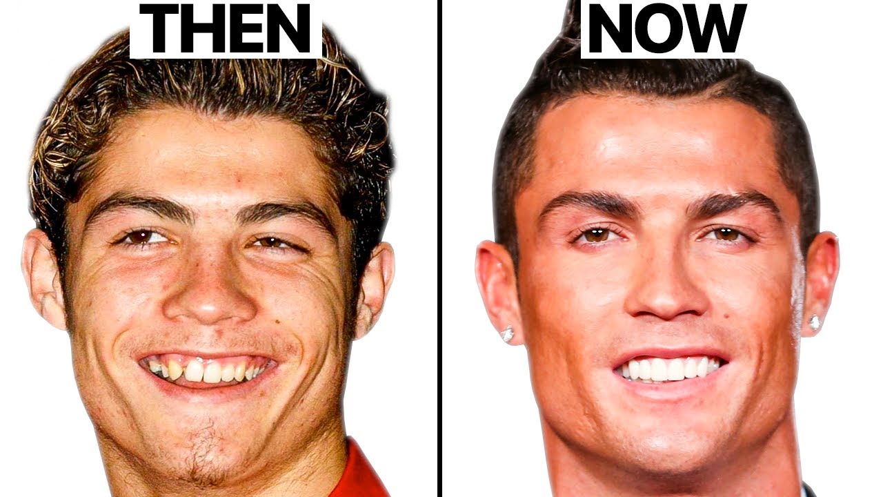 Cristiano Ronaldo NEW FACE | Plastic Surgery Analysis