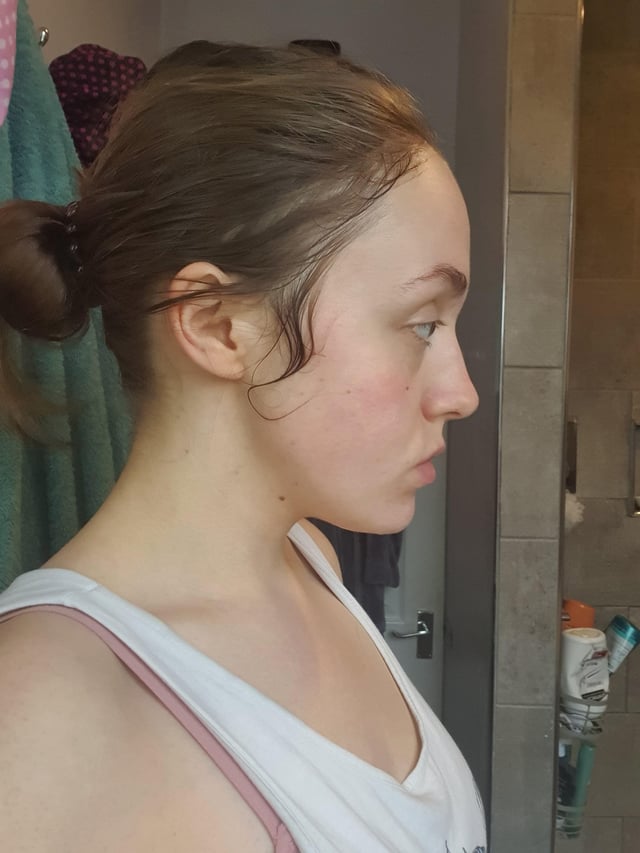 r/truerateme - freshly washed face - side view