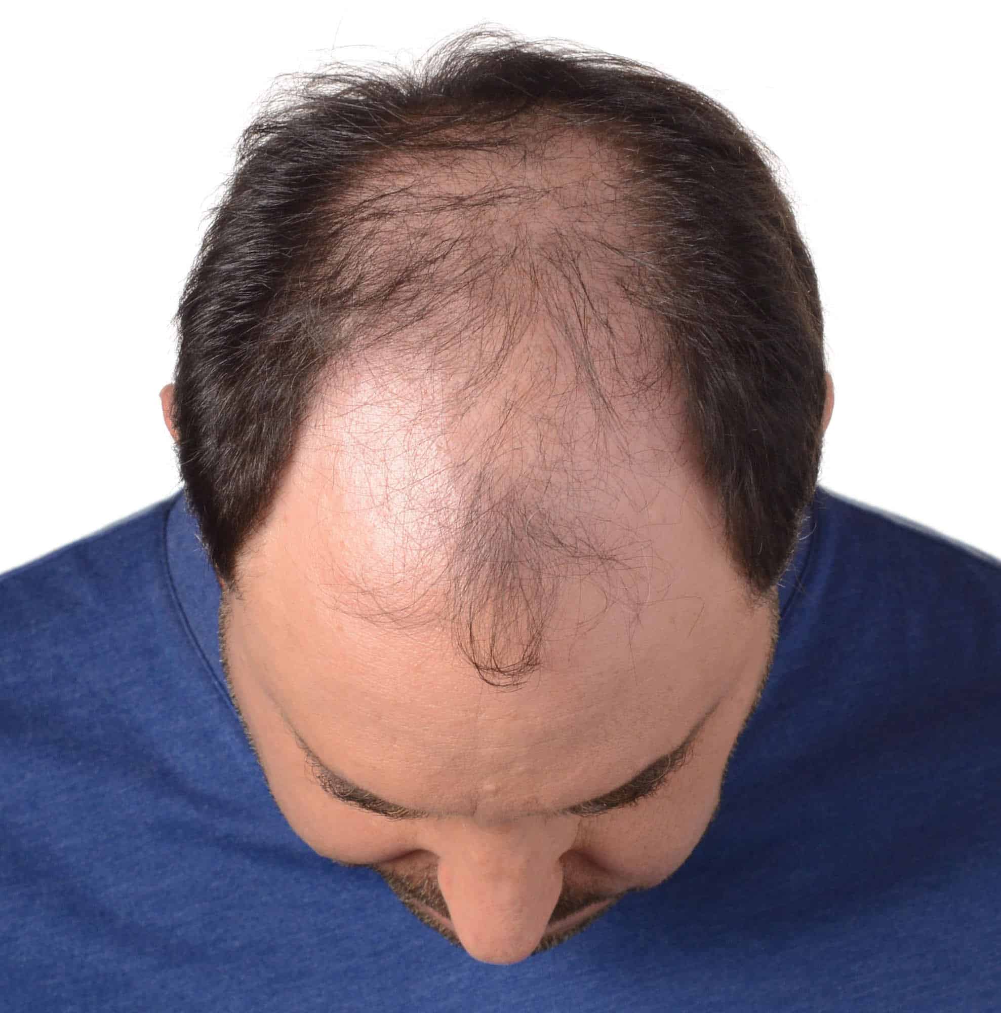 Consider-DS-Labs-shampoo-for-hair-loss2016.jpg