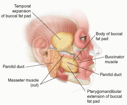 Indications and Techniques for Buccal Fat Pad Excision | Plastic Surgery Key