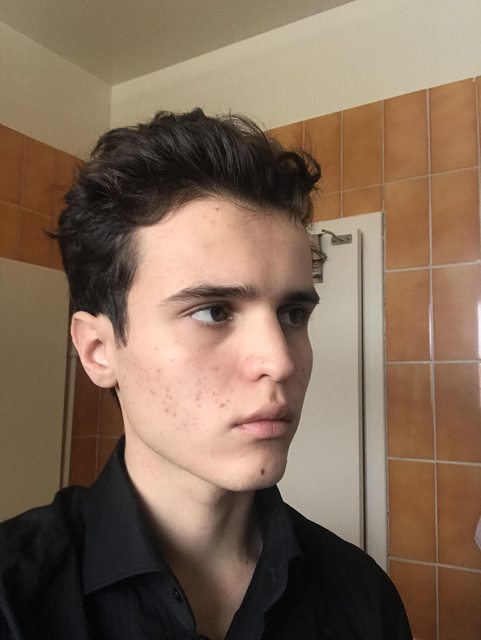 Are my zygo lowest or highest? | Looksmax.me - Mens Self ...