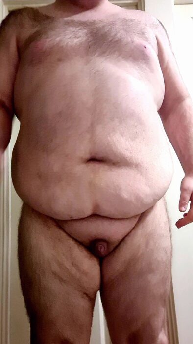 Buried_penis-scaled.jpg