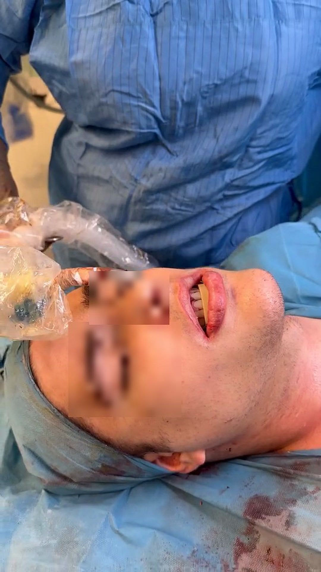 6606890_06_or_receipt_4_postop_mouth.jpg