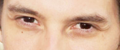 Do black eyes exist? - Speculations - Science Forums