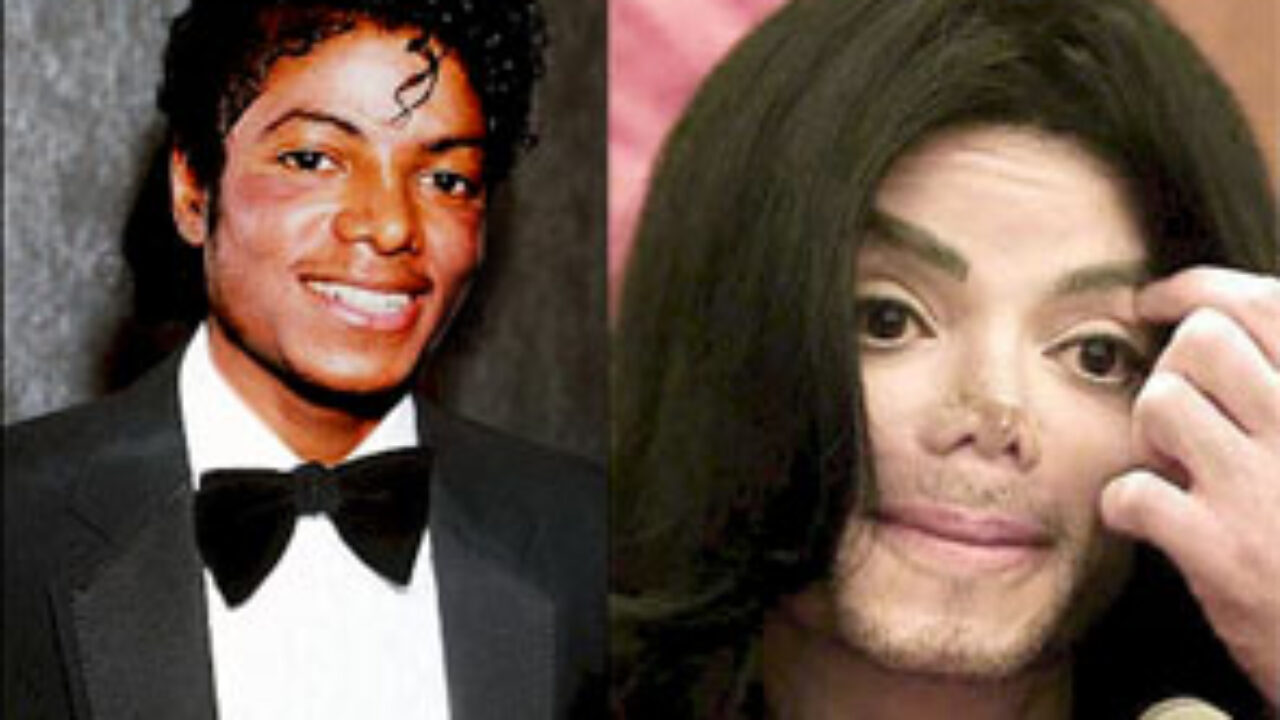 Michael Jackson to Undergo Surgery to Reverse Whiteness - Daily Squib