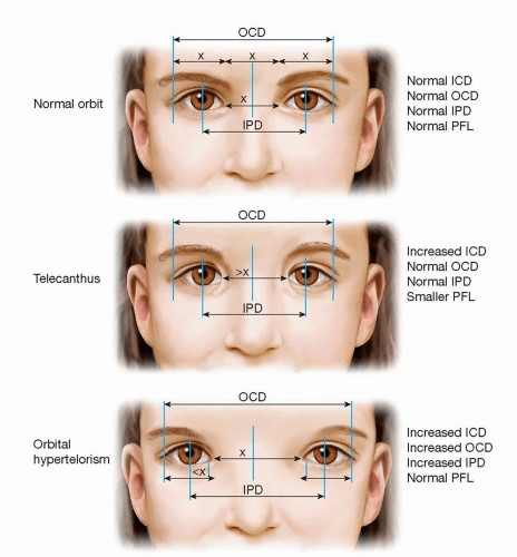 eye-orbital-features.jpg