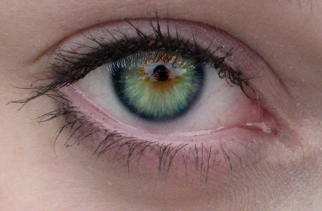 thenaturallight: Central heterochromia is an eye... | a messy work of art