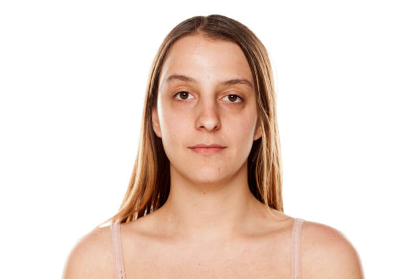 young-woman-without-makeup-on-white-background-picture-id1175864022