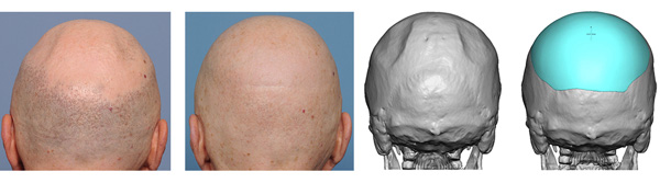 Before-After_3D_Skull2_600x167.jpg