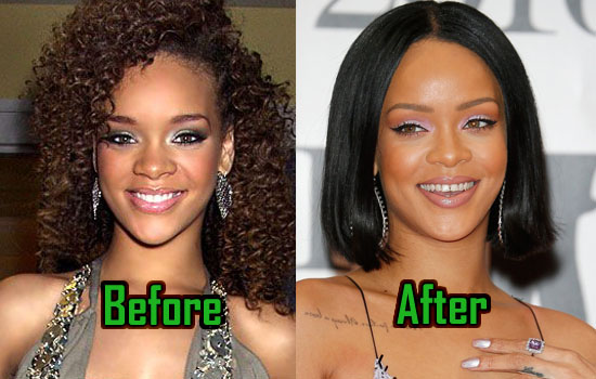 Rihanna-Plastic-Surgery.jpg