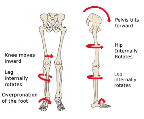 Pronation-Effects.jpg