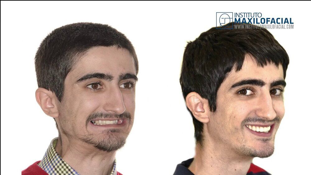 YHdOnxH.jpg
