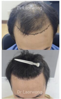 absolutehairclinic.com