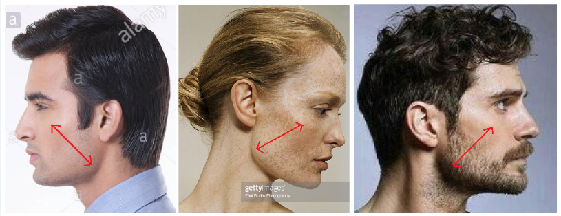 Jaws: Masseter pattern vs Temporal pattern – Main Forum – Correction  Methods – Whole Body Breathing Community