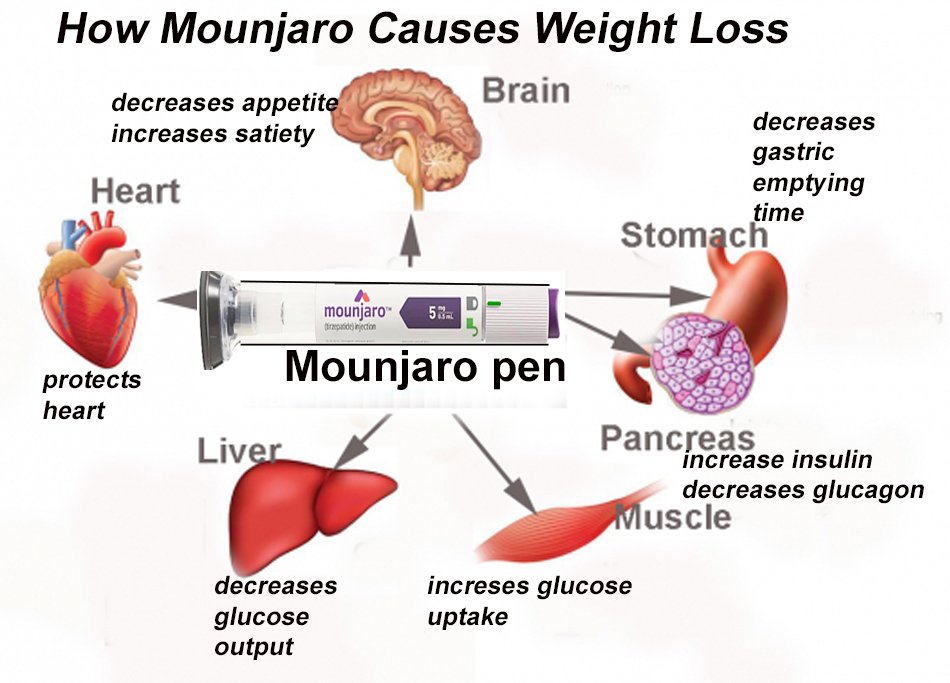 mounjaroproducesweightloss.jpg