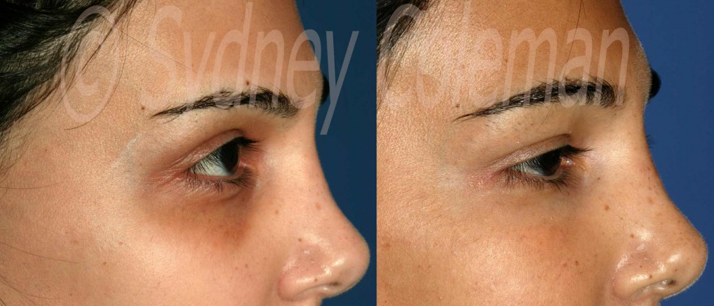 www.colemanlipostructure.com