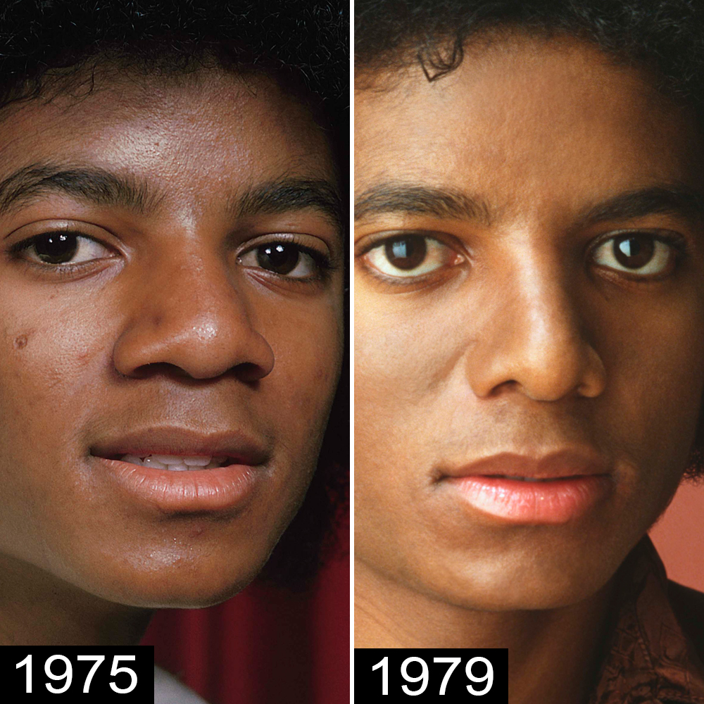 michael-jackson-first-nose-job.jpg