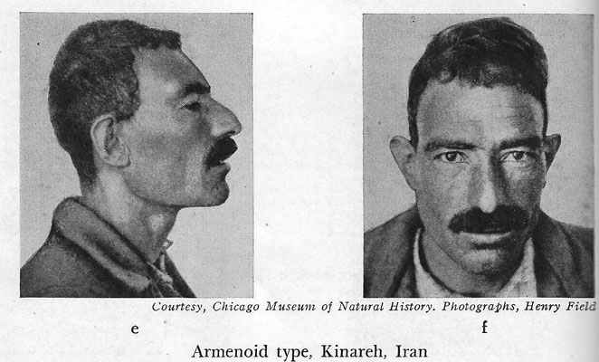 podrasa-armenoidalna.jpg
