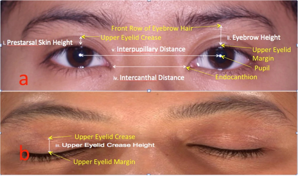 interocular-distance.jpg