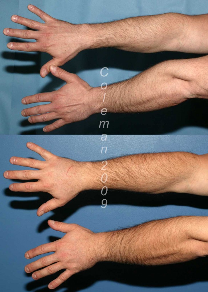 20-mo-dorsal1-729x1024.jpg