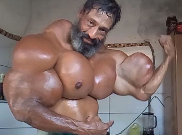 valdir-segato-synthol-bizarro-deformado-31052019162419534