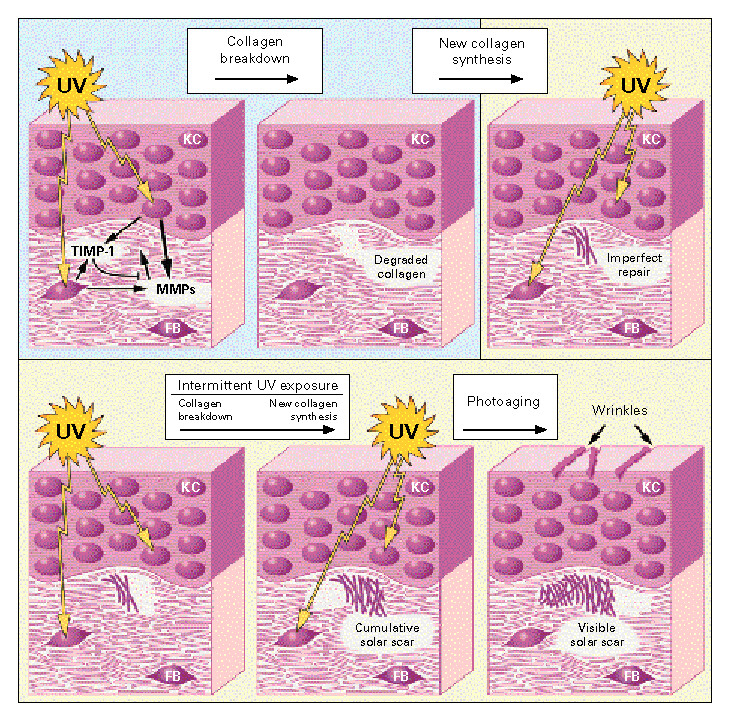 Nejm199711133372003 f5