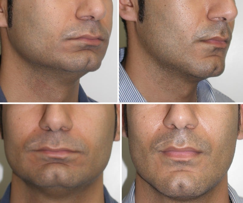 One Midlothian VA, Cosmetic Facial Surgery