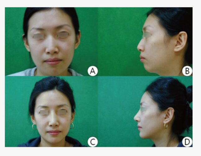 IMG 20260302 232836 395