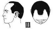 www.hairrestorationnetwork.com